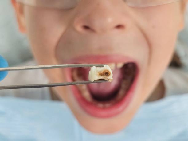 Best Mobile Emergency Dentist in Town N Country, FL